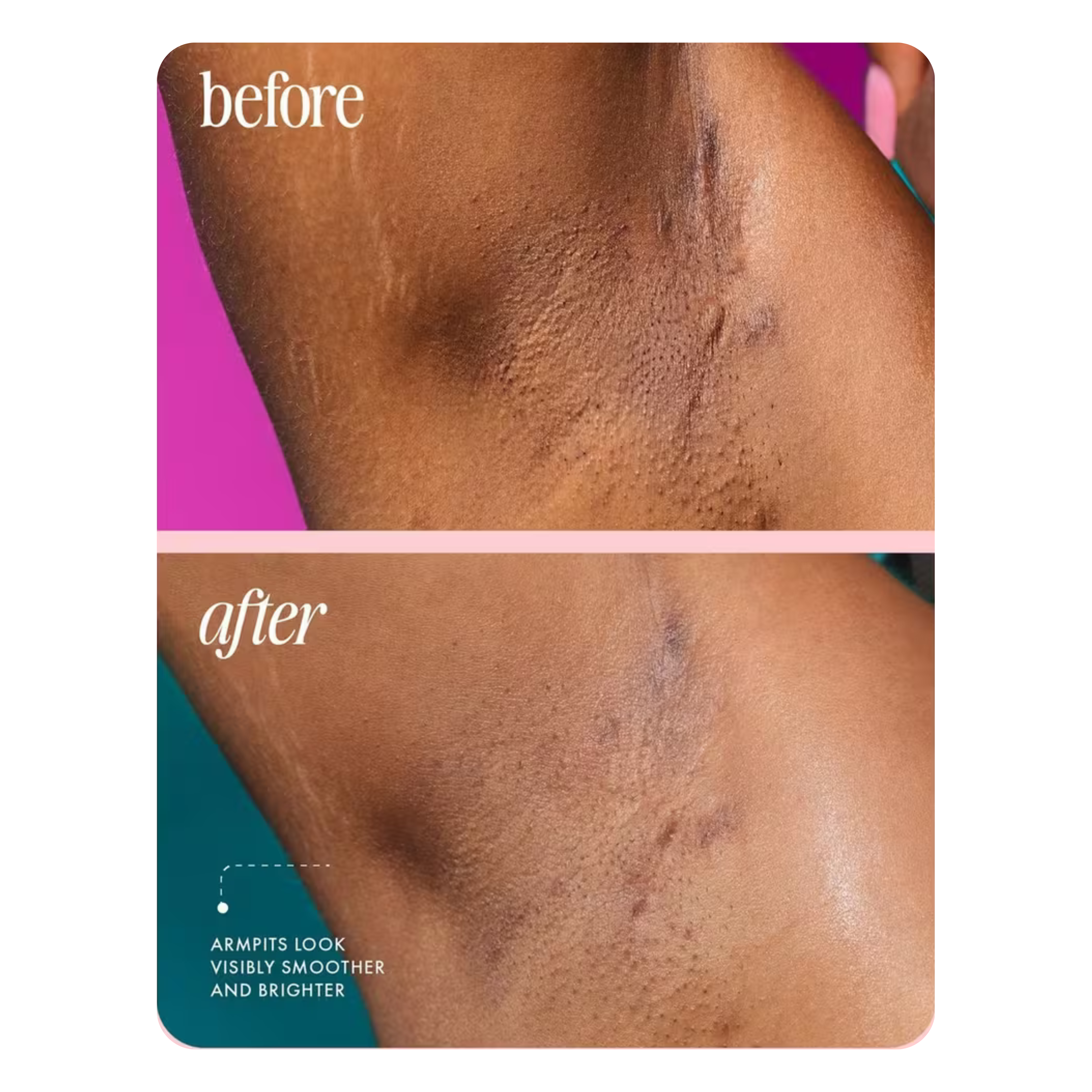 Unicorn Fruit Desodorante